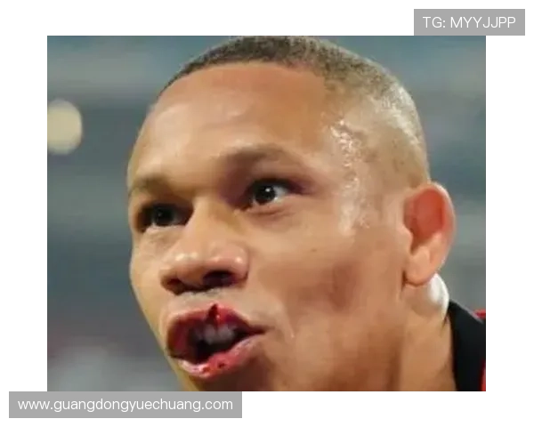 慎看韦林顿上唇裂伤特写画面